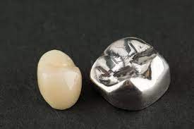 3D Printed CoCr Implant Crown