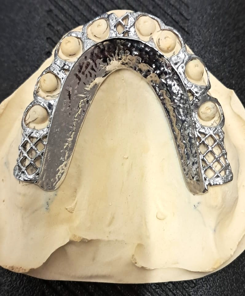 3D Printed CoCr Frame without clasps