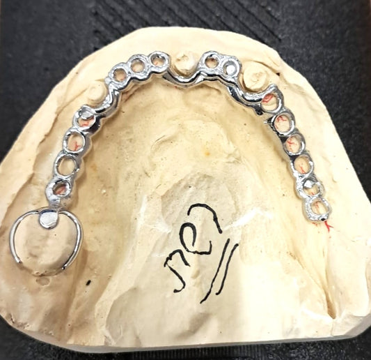 3D Printed CoCr Mesh with a Clasp